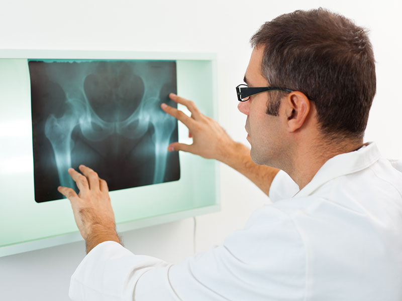 Male doctor examining X-ray image